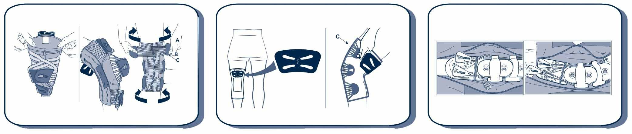 M-Brace Vega Aligner #43 - SpaSupply