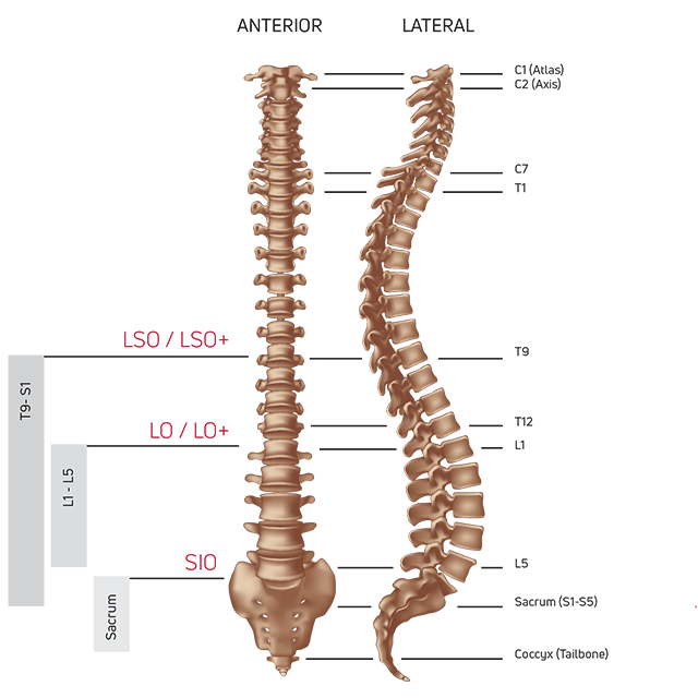 Orthèse Dorsale DONJOY ISOFORM® SIO